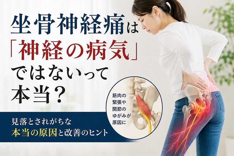 坐骨神経痛は「神経の病気」ではないって本当？と題し、腰から脚にかけて痛みを感じて悩む女性と、骨盤・筋肉・坐骨神経のイメージを描いたコラムのヘッダー画像