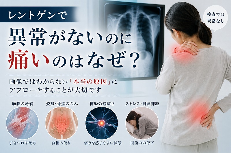 レントゲンでは異常がないのに、肩や腰に痛みを感じる女性と、画像に映らない痛みの原因として筋膜の癒着、姿勢・骨盤の歪み、神経の過敏さ、ストレスによる回復力の低下を示したイメージ。