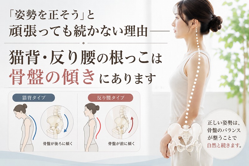 姿勢を正そうとしても続かない原因を、骨盤の傾きとの関係から解説するイラスト。猫背では骨盤が後ろへ傾き、反り腰では骨盤が前へ傾く様子を比較し、正しい姿勢は骨盤のバランスが整うことで自然に保ちやすくなることを示している。