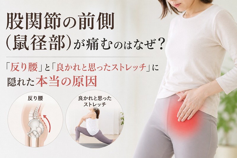 股関節の前側（鼠径部）の痛みを訴えて手で押さえる女性と、反り腰やストレッチによる股関節への負担を示したイラスト
