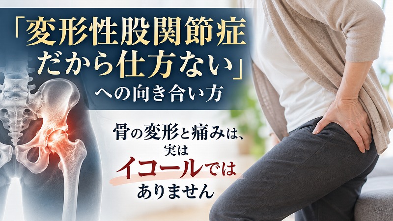 変形性股関節症と診断され、股関節を押さえて痛がる女性と、股関節の骨を赤く示したレントゲン画像。「骨の変形と痛みは、実はイコールではありません」という文字が入ったコラムのヘッダー画像。