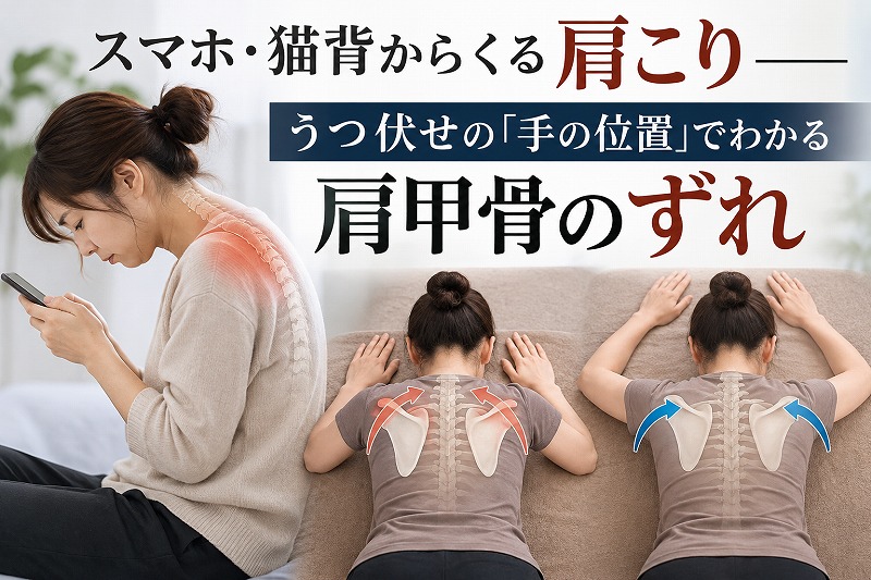 スマホの使用による猫背と肩こり、うつ伏せの手の位置から見る肩甲骨のずれを解説するイラスト